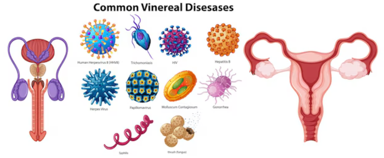 Dr amir khan Veneral diseases